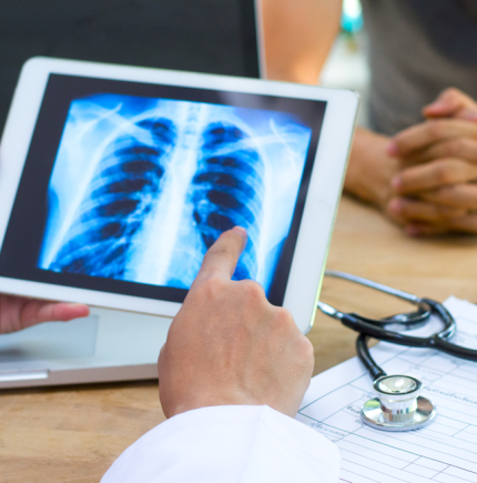 Chest xray Chest xray